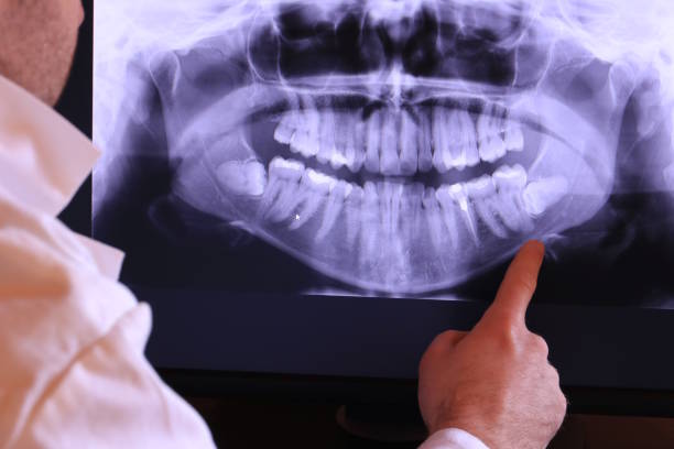 Best Emergency Treatment for Jaw Pain or Injury in Fulton, MO